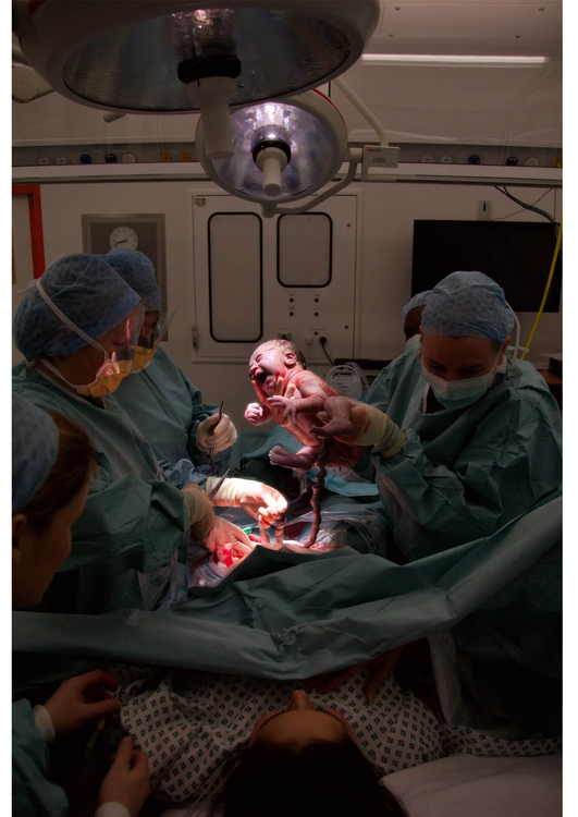 Foto Geburt mit Kaiserschnitt