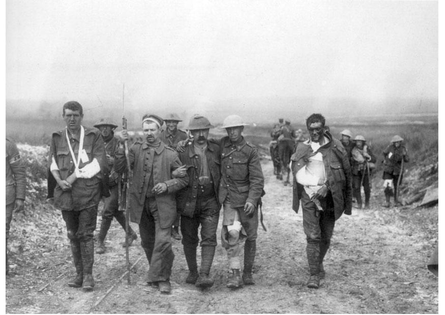 verwundete britische soldaten Foto verwundete britische soldaten