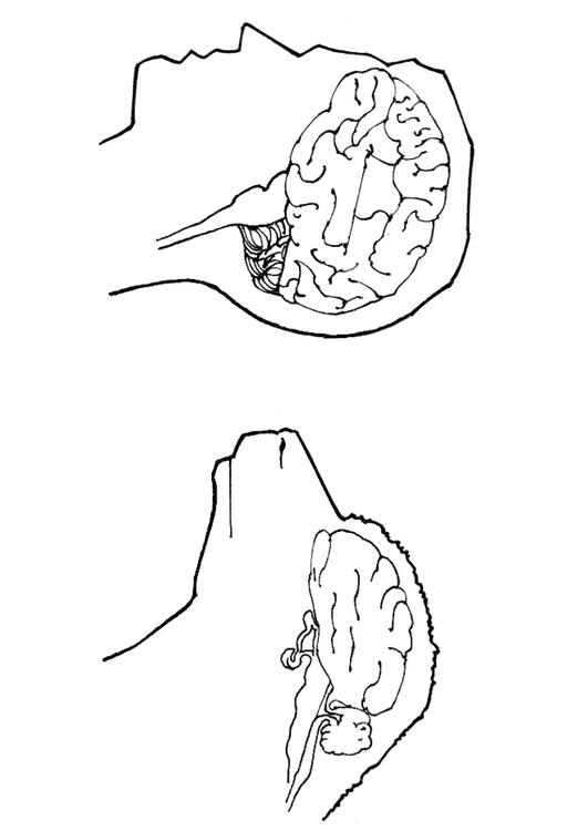Gehirn von Mensch und Schaf